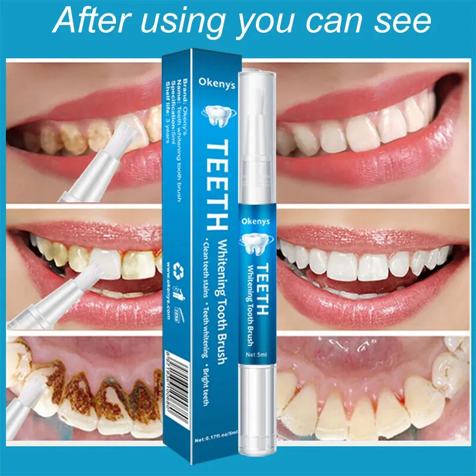 Instant Smile Teeth Whitening Pen